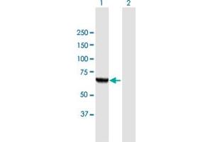 Western Blot analysis of PGM3 expression in transfected 293T cell line by PGM3 MaxPab polyclonal antibody. (Phosphoglucomutase 3 Antikörper  (AA 1-542))