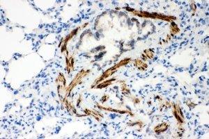 IHC-P: ATP2A2 antibody testing of rat lung tissue