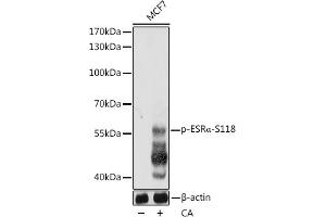 Western blot analysis of extracts of MCF7 cells, using Phospho-ESRα-S118 pAb  at 1:1000 dilution. (Estrogen Receptor alpha Antikörper  (pSer118))