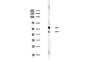 Western blot analysis of lysates from  cells(heat-shock,45 min treatment), using ANGPTL4 Antibody at 1/1000 dilution.