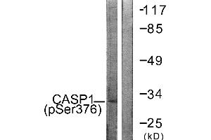 Immunohistochemistry analysis of paraffin-embedded human brain tissue using Caspase 1 (Phospho-Ser376) antibody. (Caspase 1 Antikörper  (pSer376))