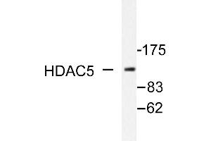 Image no. 1 for anti-Histone Deacetylase 5 (HDAC5) antibody (ABIN271892) (HDAC5 Antikörper)