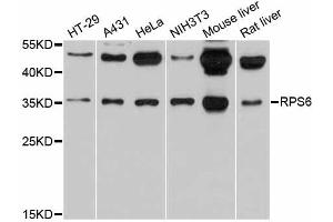 Western blot analysis of extracts of various cell lines, using RPS6 antibody (ABIN5973596) at 1/1000 dilution. (RPS6 Antikörper)