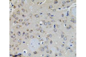 Immunohistochemistry of paraffin-embedded Rat brain using AURKC Polyclonal Antibody (Aurora Kinase C Antikörper)