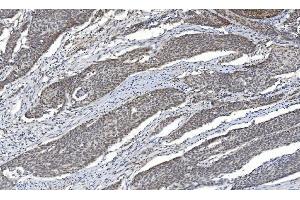IHC analysis of HDAC5 using anti-HDAC5 antibody (ABIN7599922). (HDAC5 Antikörper  (AA 13-1107))