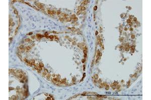 Immunohistochemistry (Formalin-fixed Paraffin-embedded Sections) (IHC (fp)) image for anti-Deleted in Azoospermia 1 (DAZ1) (AA 21-120) antibody (ABIN560564)