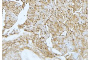ABIN6277269 at 1/100 staining Mouse muscle tissue by IHC-P. (FLIP Antikörper  (Internal Region))