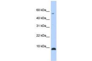 Image no. 1 for anti-Chemokine (C-X-C Motif) Ligand 6 (CXCL6) (C-Term) antibody (ABIN6740256) (CXCL6 Antikörper  (C-Term))