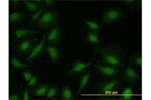 Immunofluorescence (IF) image for anti-Mitogen-Activated Protein Kinase-Activated Protein Kinase 2 (MAPKAPK2) (AA 302-400) antibody (ABIN563999)