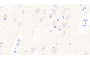 Detection of GP6 in Human Cerebrum Tissue using Polyclonal Antibody to Glycoprotein VI (GP6) (GP6 Antikörper  (AA 86-231))