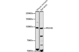 Western blot analysis of extracts of various cell lines, using PRDM9 antibody (ABIN7269501) at 1:1000 dilution. (PRDM9 Antikörper)