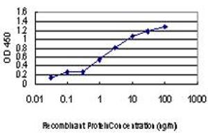 Detection limit for recombinant GST tagged ULK1 is approximately 0.