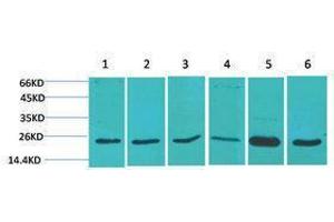 Western Blotting (WB) image for anti-Superoxide Dismutase 2, Mitochondrial (SOD2) antibody (ABIN3181553) (SOD2 Antikörper)