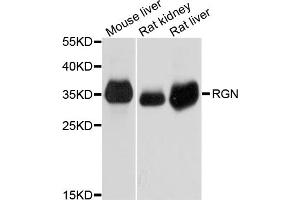 Western blot analysis of extracts of various cell lines, using RGN antibody (ABIN5995523) at 1/1000 dilution. (Regucalcin Antikörper)