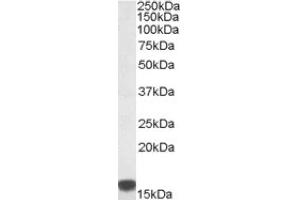 Image no. 1 for anti-S100 Calcium Binding Protein A9 (S100A9) (Internal Region) antibody (ABIN375088) (S100A9 Antikörper  (Internal Region))