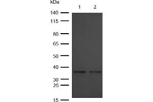 All lanes : OXGR1 Rabbit mAb at 1/1k dilution Lane 1 : Mouse Kidney lysates Lane 2 : Rat Spleen lysates Lysates/proteins at 20 μg per lane. (Rekombinanter OXGR1 Antikörper)