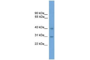 WB Suggested Anti-MAPK13 Antibody Titration: 0.