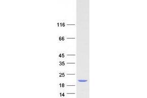 Western Blotting (WB) image for Splicing Factor 3b, Subunit 1, 155kDa (SF3B1) (Transcript Variant 2) protein (Myc-DYKDDDDK Tag) (ABIN2731899)