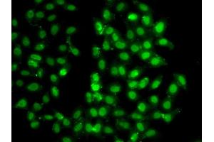 Immunofluorescence analysis of U20S cell using PSMD8 antibody. (PSMD8 Antikörper)