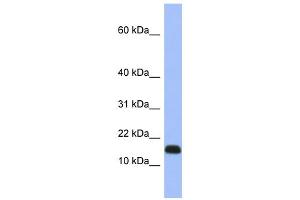 WB Suggested Anti-RPL37A Antibody Titration: 0. (RPL37A Antikörper  (Middle Region))