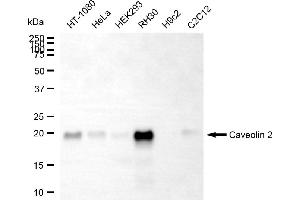 Western blotting analysis using caveolin 2 antibody (ABIN7797945).
