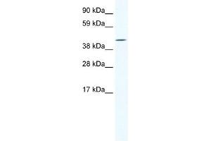 Western Blot showing IRX6 antibody used at a concentration of 1-2 ug/ml to detect its target protein. (IRX6 Antikörper  (C-Term))
