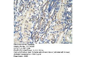 Rabbit Anti-EIF4E2 Antibody  Paraffin Embedded Tissue: Human Kidney Cellular Data: Epithelial cells of renal tubule Antibody Concentration: 4. (EIF4E2 Antikörper  (N-Term))