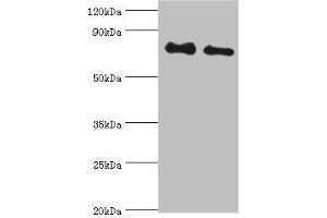 Western blot All lanes: Cytoplasmic tyrosine-protein kinase BMX antibody at 4 μg/mL Lane 1: A549 whole cell lysate Lane 2: Mouse heart tissue Secondary Goat polyclonal to rabbit IgG at 1/10000 dilution Predicted band size: 78 kDa Observed band size: 78 kDa (BMX Antikörper  (AA 65-280))