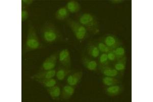 Immunofluorescent analysis of Hela cells fixed fixed by 4 % paraformaldehyde and using SIRT6 mouse mAb (dilution 1:100). (SIRT6 Antikörper)