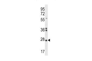 NKAIN1 Antibody (C-term) (ABIN656410 and ABIN2845704) western blot analysis in K562 cell line lysates (35 μg/lane). (NKAIN1 Antikörper  (C-Term))