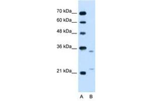 Image no. 1 for anti-Low Density Lipoprotein Receptor-Related Protein Associated Protein 1 (LRPAP1) (AA 258-307) antibody (ABIN205076) (LRPAP1 Antikörper  (AA 258-307))