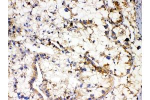 IHC analysis of APOL1 using anti-APOL1 antibody (ABIN7600725). (APOL1 Antikörper  (AA 228-398))