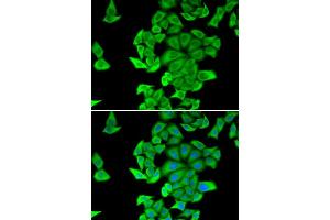 Immunofluorescence analysis of HeLa cell using SMYD2 antibody.