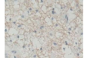 Immunohistochemistry (IHC) image for anti-Flavin Reductase (BLVRB) (AA 2-206) antibody (ABIN7441571)