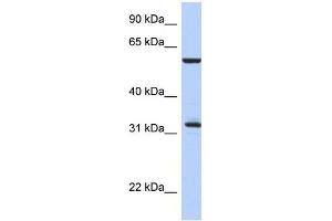 Western Blot showing CDC34 antibody used at a concentration of 1-2 ug/ml to detect its target protein. (CDC34 Antikörper  (Middle Region))