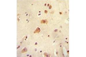 Formalin fixed, paraffin embedded human brain tissue stained with RICH2 Antibody (C-term) followed by peroxidase conjugation of the secondary antibody and DAB staining. (ARHGAP44 Antikörper  (C-Term))