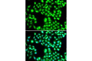 Immunofluorescence analysis of MCF-7 cells using YTHDC1 antibody (ABIN5974420). (YTHDC1 Antikörper)