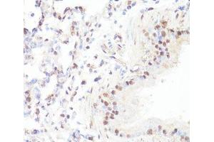 Immunohistochemistry (Paraffin-embedded Sections) (IHC (p)) image for anti-Myc Proto-Oncogene protein (MYC) (pSer62) antibody (ABIN7265076)