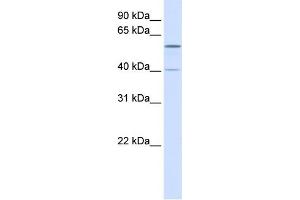 WB Suggested Anti-TRIM49 Antibody Titration:  0. (TRIM49 Antikörper  (N-Term))