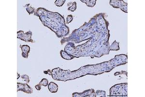 IHC analysis of GLDC using anti-GLDC antibody (ABIN7602072). (GLDC Antikörper  (AA 574-1020))