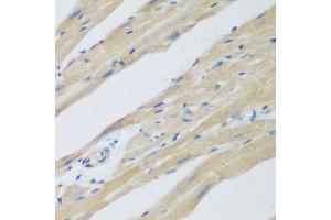 Immunohistochemistry of paraffin-embedded mouse heart using WDR77 antibody at dilution of 1:200 (40x lens). (WDR77 Antikörper)