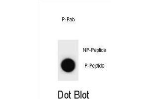 Dot blot analysis of Mouse p21Cip1 Antibody (Phospho S78) Phospho-specific Pab (ABIN1881617 and ABIN2837843) on nitrocellulose membrane. (p21 Antikörper  (pSer78))