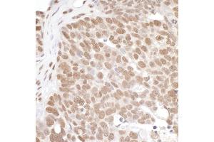 anti-Protein Arginine Methyltransferase 1 (PRMT1) (AA 1-50) antibody