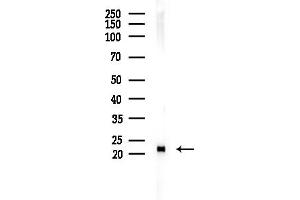 anti-Loss of Heterozygosity, 12, Chromosomal Region 1 (LOH12CR1) (Internal Region) antibody