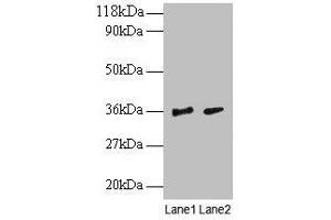 Western blot All lanes: SNRPG antibody at 2 μg/mL Lane 1: EC109 whole cell lysate Lane 2: 293T whole cell lysate Secondary Goat polyclonal to rabbit IgG at 1/15000 dilution Predicted band size: 9 kDa Observed band size: 36 kDa (SNRPG Antikörper  (AA 1-76))
