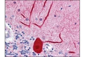 Human Brain, cerebellum: Formalin-Fixed, Paraffin-Embedded (FFPE) (ENPEP Antikörper  (Tyr182))