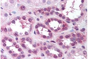 Human Kidney (formalin-fixed, paraffin-embedded) stained with RELA antibody ABIN218582 at 1:500 followed by biotinylated goat anti-rabbit IgG secondary antibody ABIN481713, alkaline phosphatase-streptavidin and chromogen. (NF-kB p65 Antikörper  (pSer529))