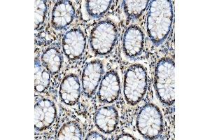 IHC analysis of SNRPD2 using anti-SNRPD2 antibody (ABIN7598963).