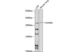 Western blot analysis of extracts of various cell lines, using PLXNB1 antibody (ABIN6129763, ABIN6145806, ABIN6145807 and ABIN6214109) at 1:1000 dilution. (PLXNB1 Antikörper  (AA 250-470))