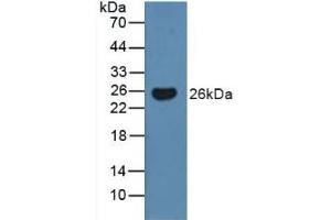 Detection of BMF in Human Serum using Polyclonal Antibody to Bcl2 Modifying Factor (BMF) (BMF Antikörper  (AA 1-181))